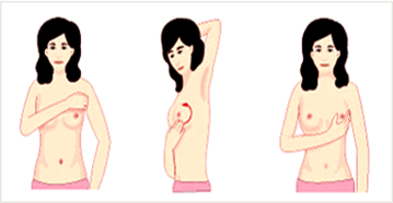 유방자가 검진 2단계