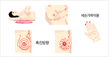 유방자가 검진 3단계